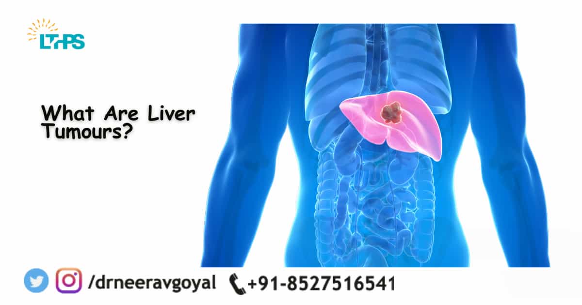 What Are Liver Tumours?